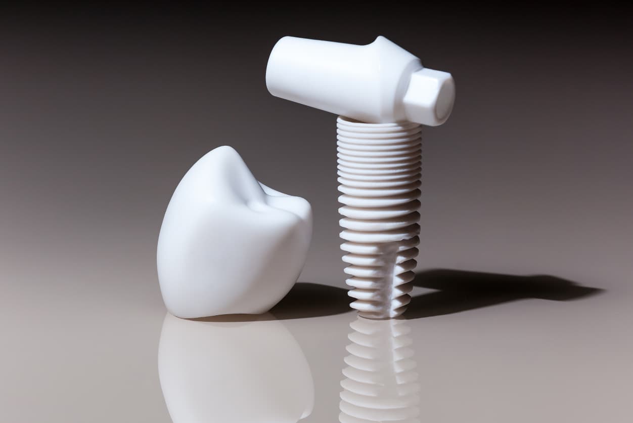 Zirconia-Implants-Fear-Free-Deicision-Making